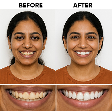 Before After 1