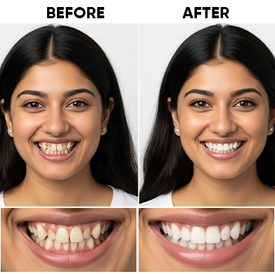 Before After 3